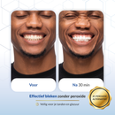 Whitening Strips